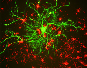 Neuron_in_tissue_culture