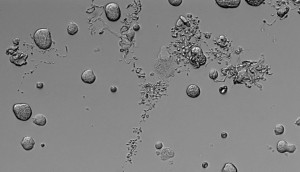 Megakaryocytes producing platelets