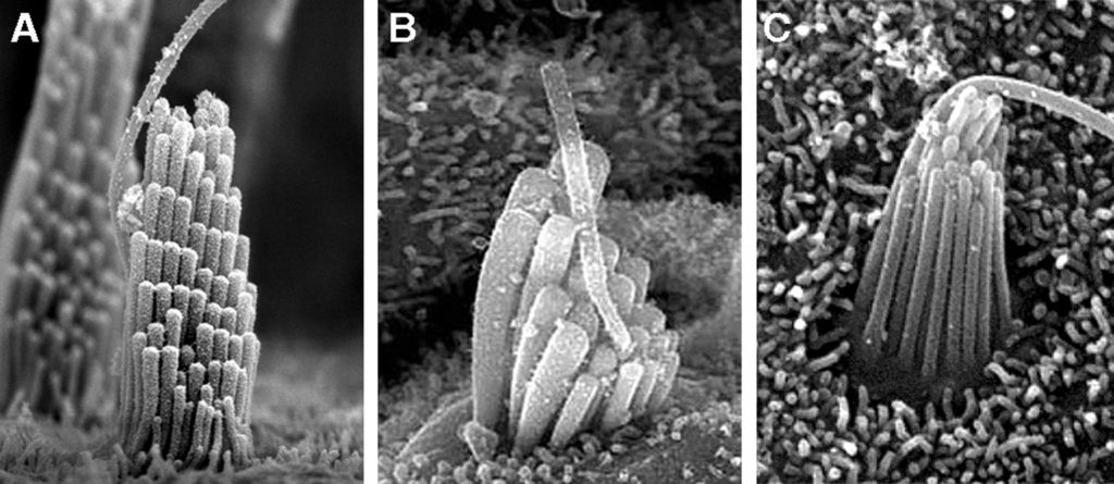 Inner ear sensory cells. (A) A native hair cell of the mouse inner ear (from Holt et al., Cell 2002). (B) A hair cell created by Atoh1 gene therapy (from Kawamoto et al., J Neurosci 2003). (C) A stem-cell-derived hair cell (from Oshima et al., Cell 2010). Images used with permission.